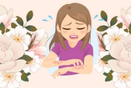 اگزما و توصیه ها